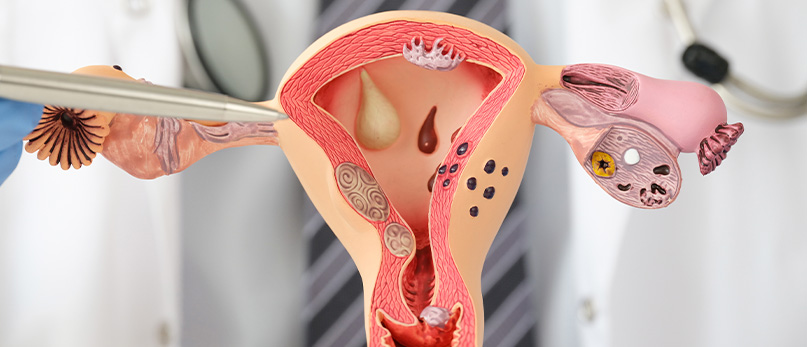luis-felipe-sallum-imagem-interna-patologias-do-trato-genital-inferior